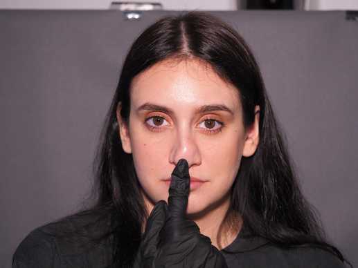 After a failed rhinoplasty